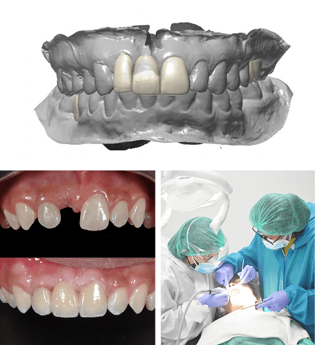 dental-proses