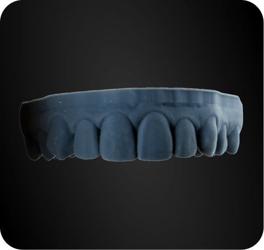 digital-smile